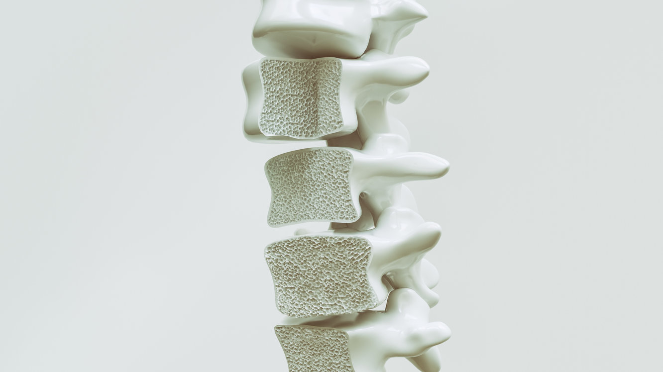 Ce este osteoporoza? Cum se tratează?