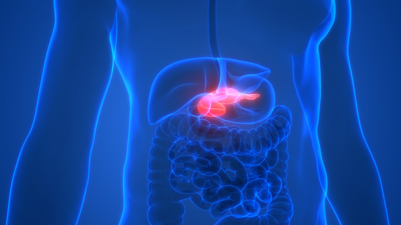 Ce este cancerul de pancreas și cum se aplică „operația Whipple” în procesul de tratament?