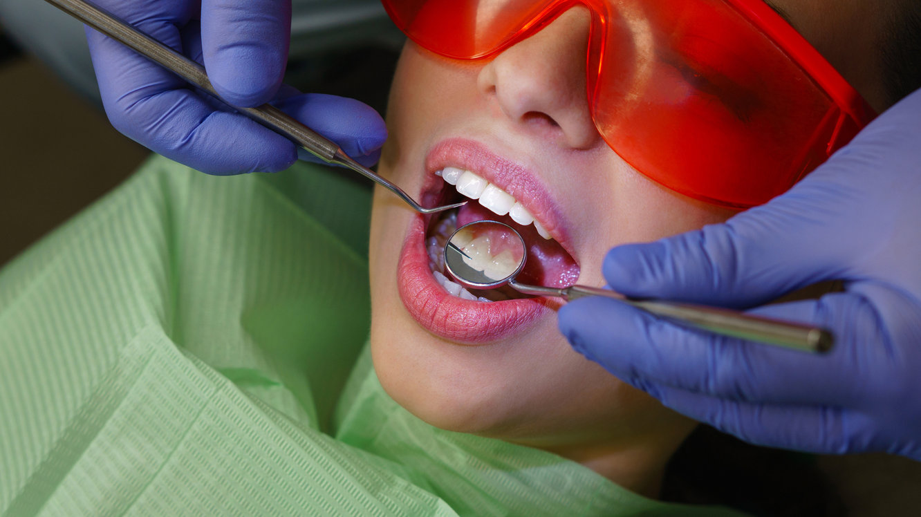 Ce este tratamentul dentar restaurator?
