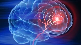 Stimulatoarele Cerebrale: O Soluție Avansată pentru Bolile Neurologice 