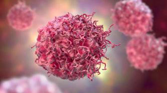 Cancerul de Țesuturi Moi (Sarkom): Ce Este, Simptome, Tipuri și Tratament