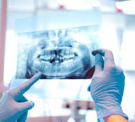 Üç Boyutlu Ağız Tarama Teknolojisiyle Sağlıklı Dişler
