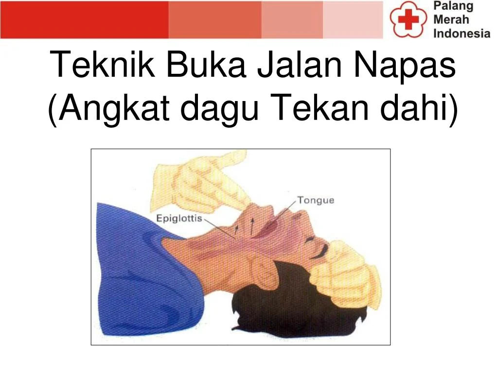 gangguan jalan napas