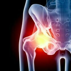 hip joint in pain