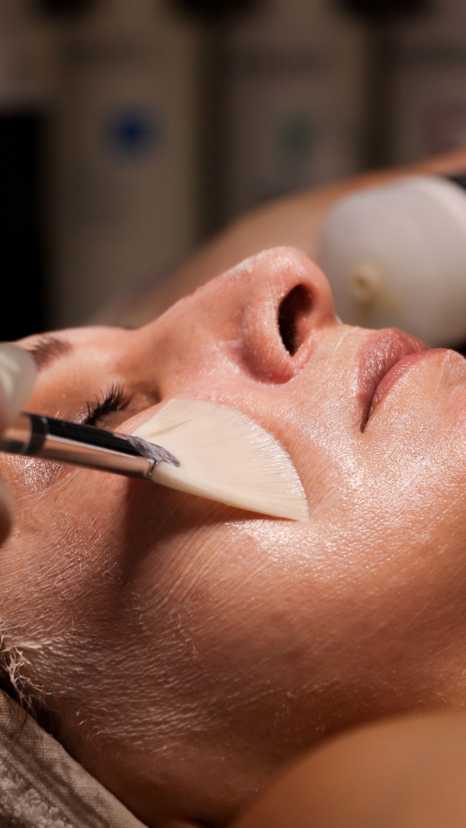 A brush applying a peel solution to a client’s cheek