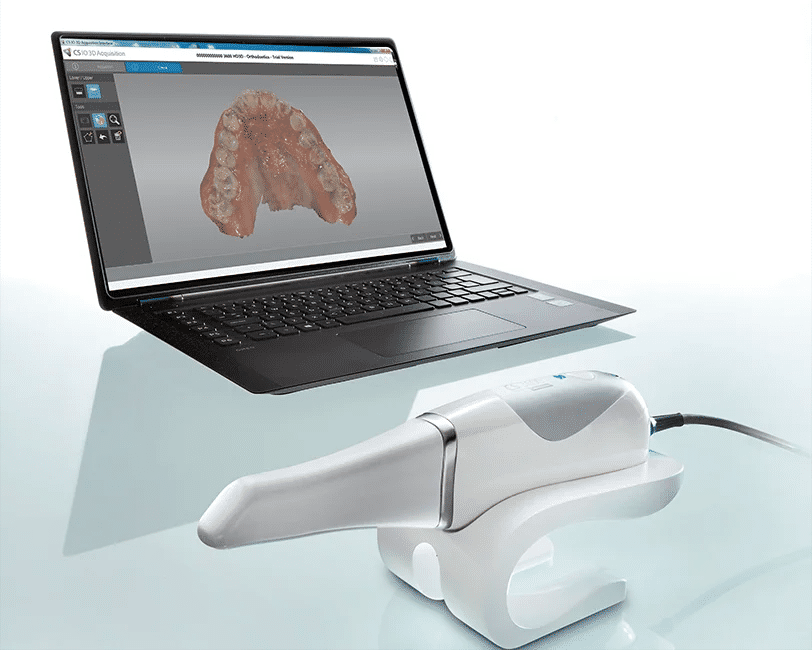 Con uno scanner 3D intraorale si può aggirare il problema