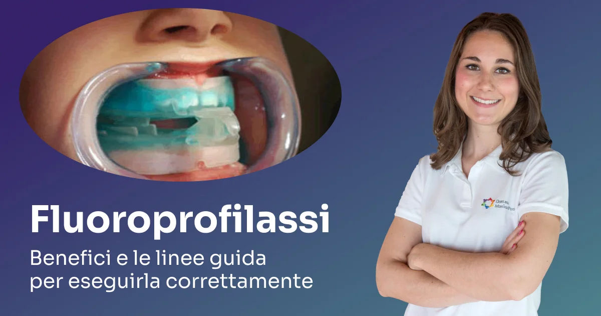 Fluoroprofilassi= i benefici e le linee guida per eseguirla correttamente