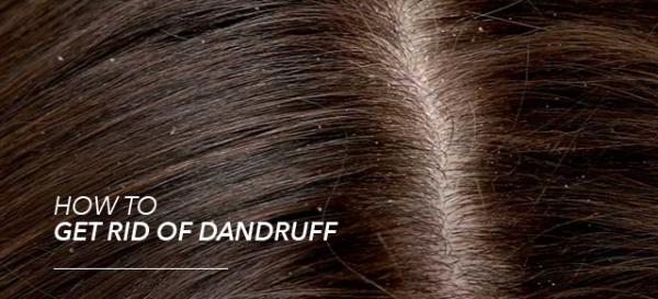 Dandruff No More!