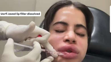 Uorfi Javed lip filler dissolved