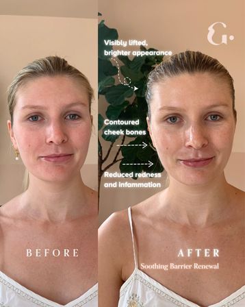 Glasskin: Start Your Group Trip With A Skin Workout Party image 6