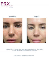 Bridal Glow Party: Private Facials, Bubbly & Good Vibes image 48