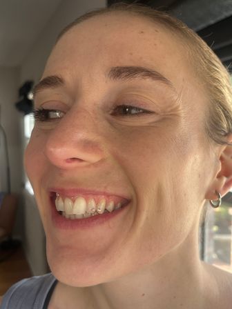 Dazzle & Sparkle: Swarovski Tooth Gem Experience image 1