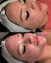 The Ultimate Glow Up: Facials, Lash Lifts, Tints & Brow Magic image 6