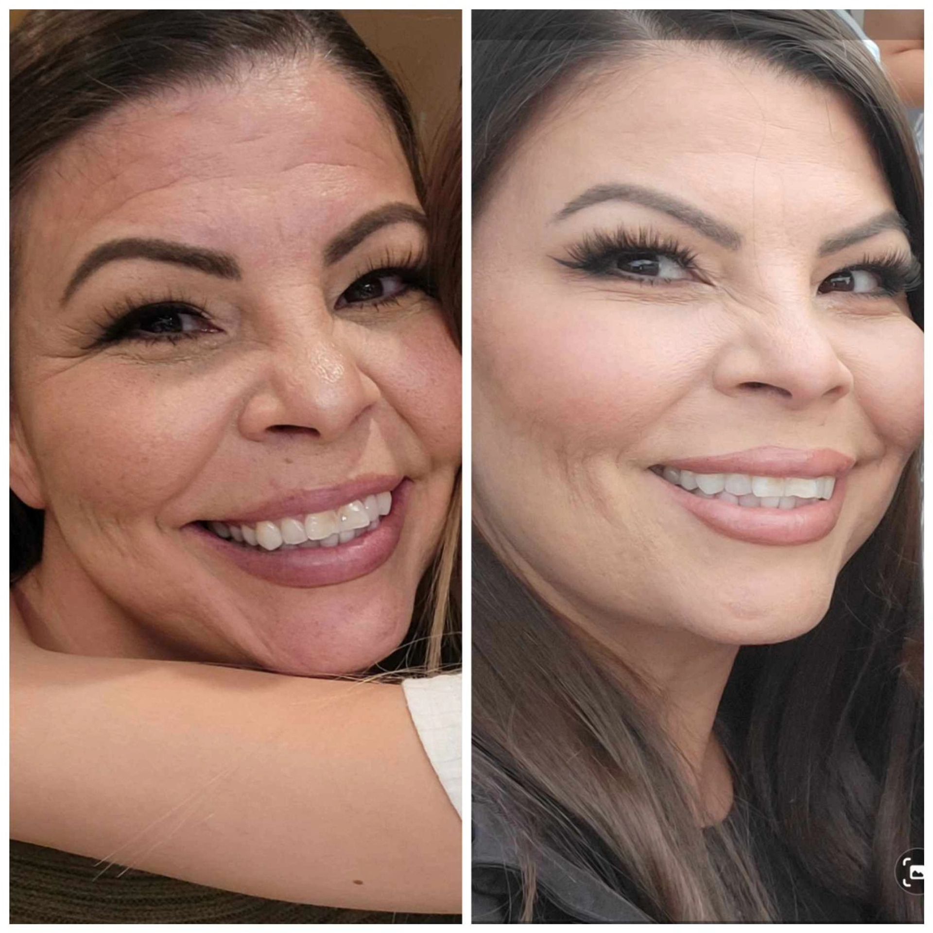 The Ultimate Wellness Spa Denver: Massage, Facials, Brows, Botox, IV Therapy & More image 2