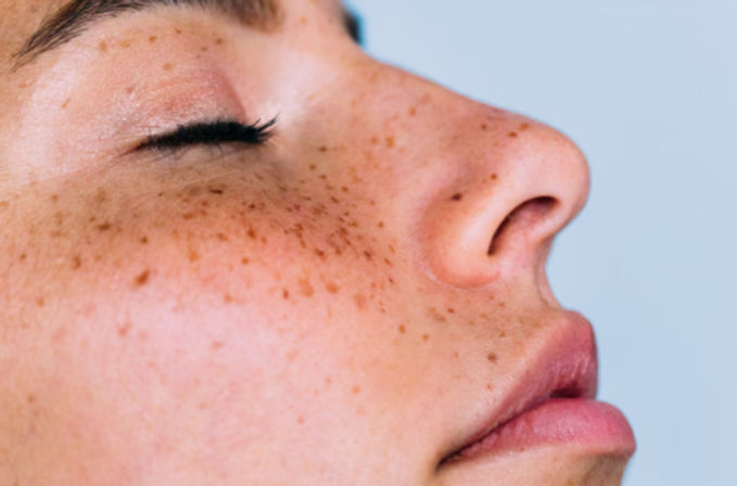 June Skin Aesthetics: Mobile Med Spa Service image 3