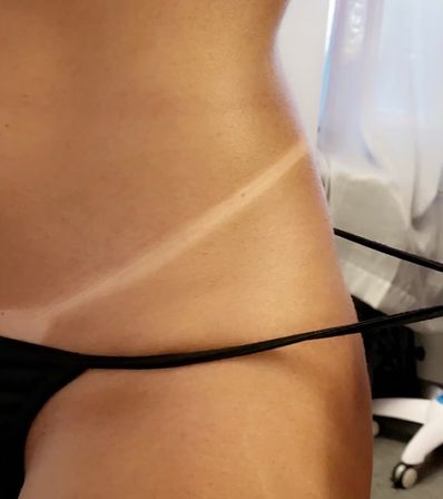 Spray Tans & Bright Smiles: Mobile or In-Office Magic image 5