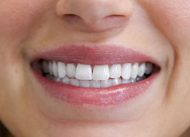 Spray Tans & Bright Smiles: Mobile or In-Office Magic image 4
