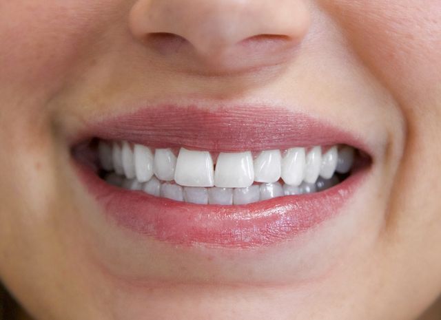 Spray Tans & Bright Smiles: Mobile or In-Office Magic image 4