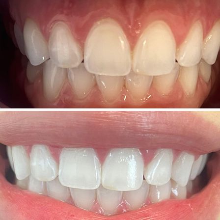 Spray Tans & Bright Smiles: Mobile or In-Office Magic image 2