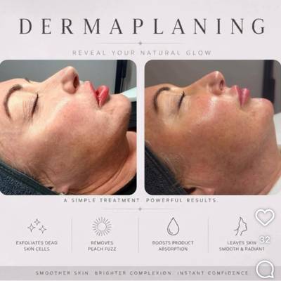 Dermaplaning Facial