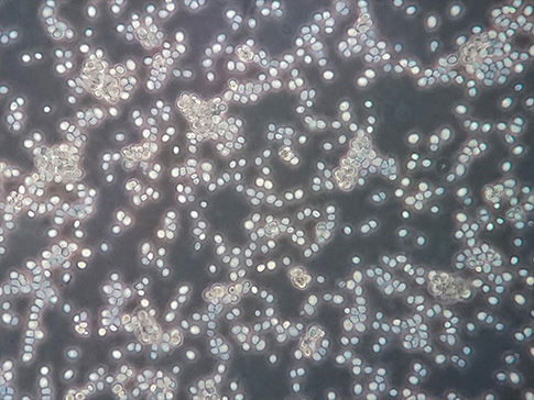 Yeast: Microscope and Cell Counting