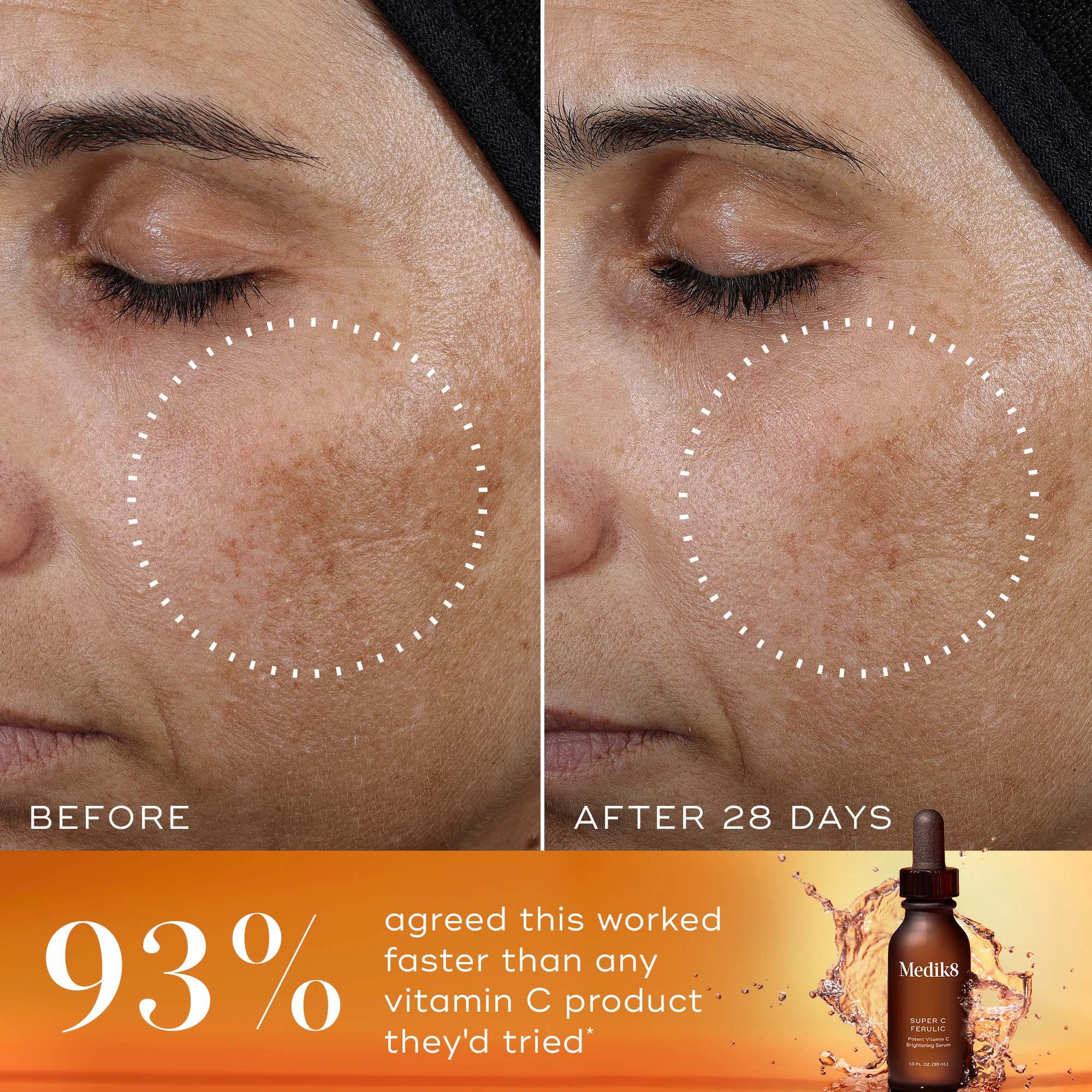 Super C Ferulic