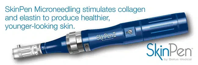 SkinPen Microneedling Treatment