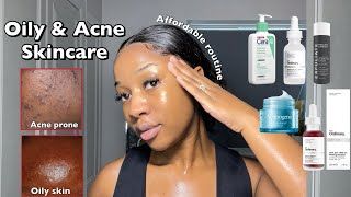 Banishing Breakouts: My Ultimate Skincare Routine for Oily, Acne-Prone Skin