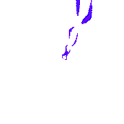 TG