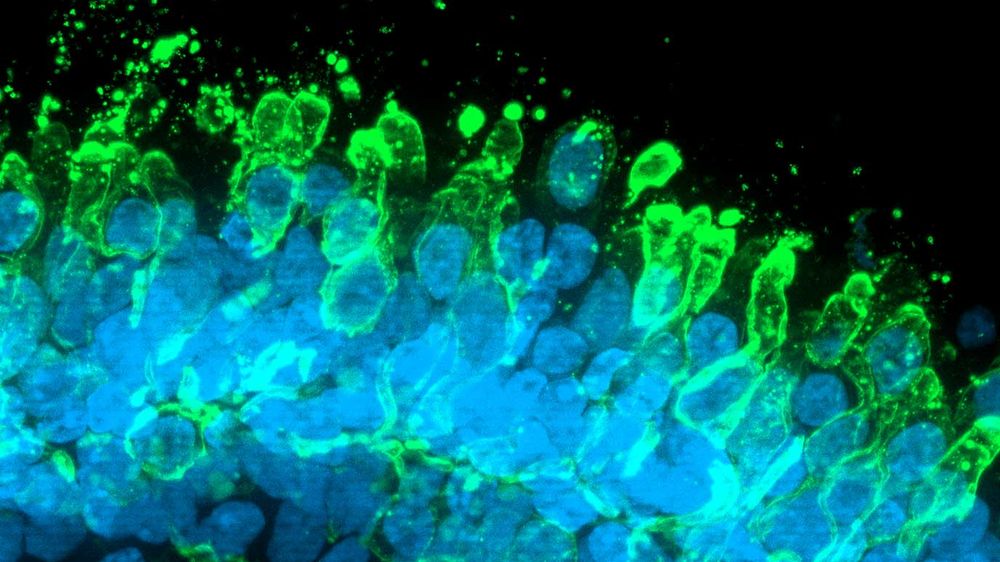 Axol Bioscience makes third acquisition in five years