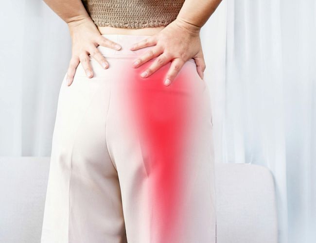 Sciatica Pain image