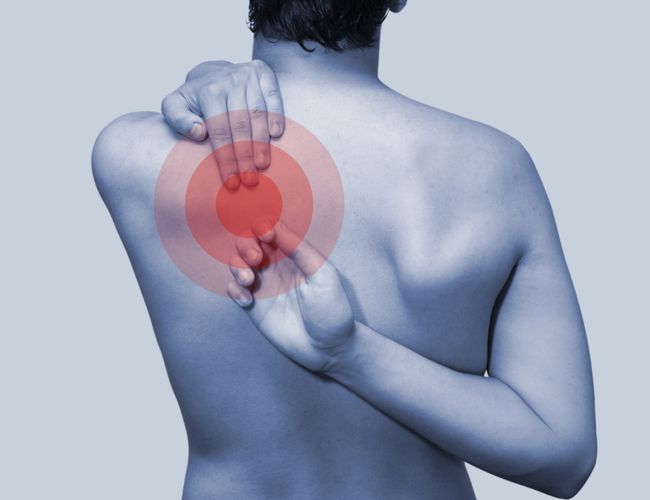 Back Pain image