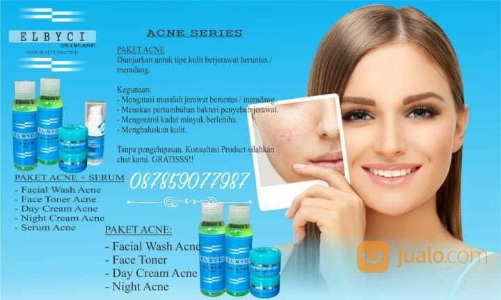 Elbyci Paket Perawatan Wajah Elbyci Acne Untuk Kulit Berjerawat Malang Jualo