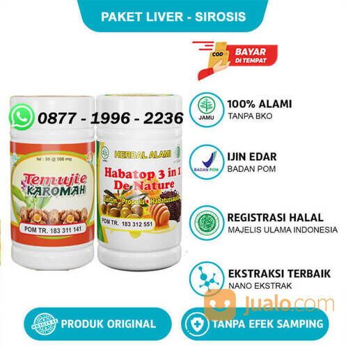 Obat Liver Ringan Dan Kronis Pembengkakan Hati Limpa Bengkak Kolestasis Sirosis Hati