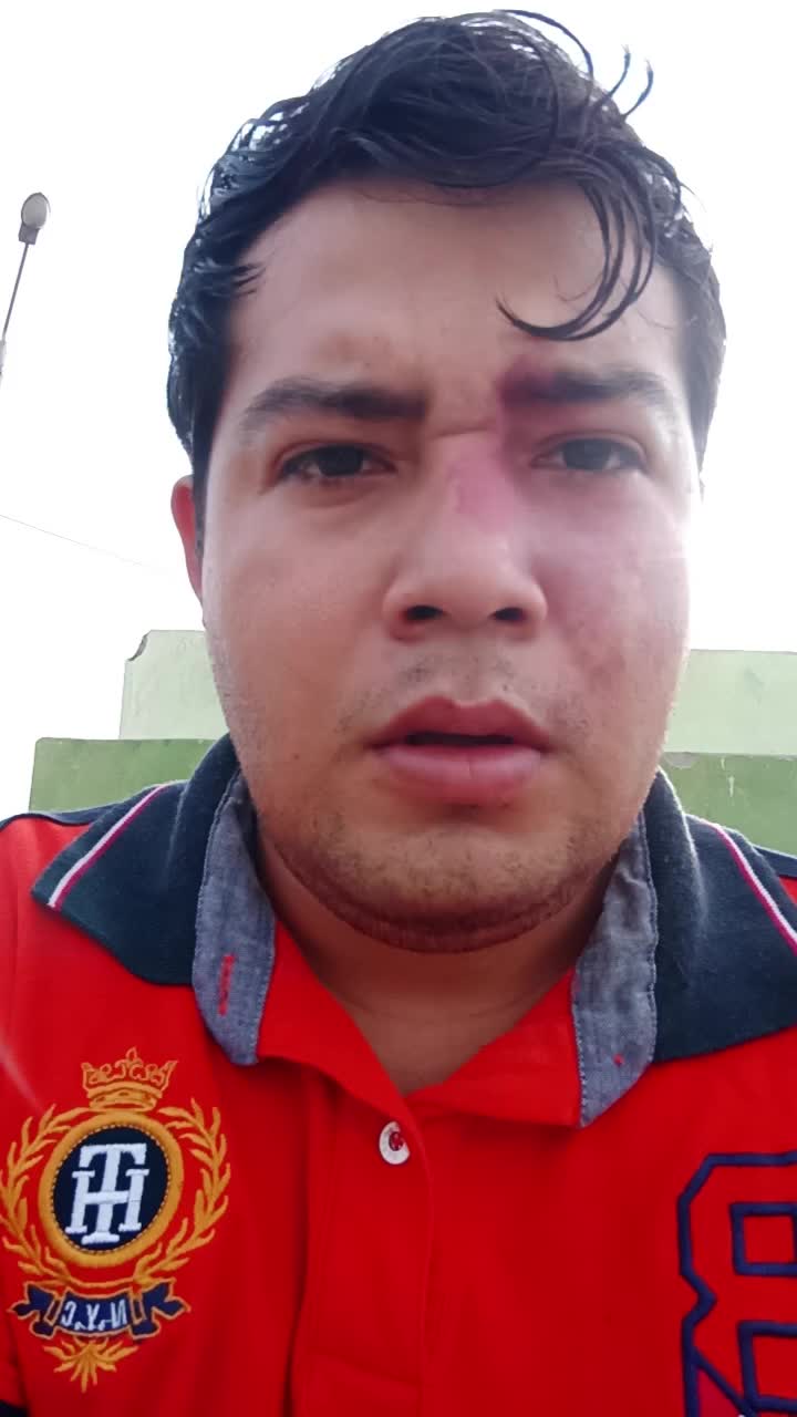 Fg telecomunicaciones 