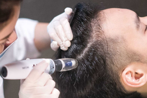 Mesotherapy