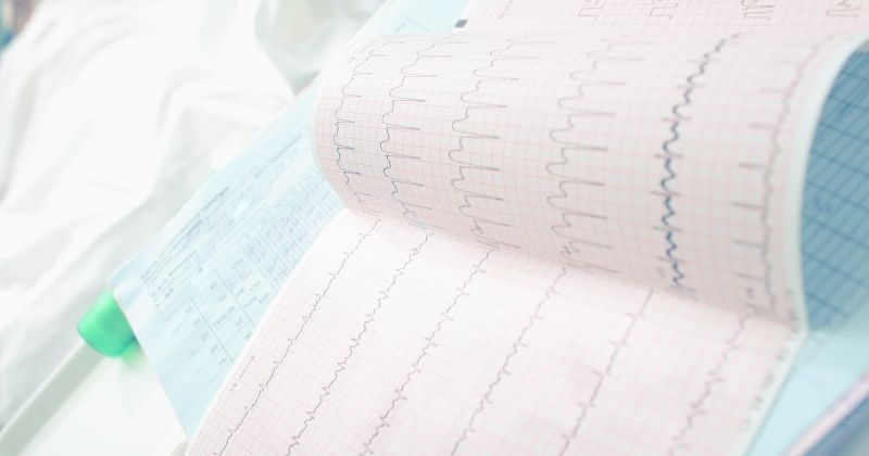 Analyzing ECG of patient in the ward