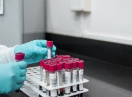 Komunikat Prezesa URPL w sprawie dostarczania i udostępniania laikom wyrobów medycznych do diagnostyki in vitro
