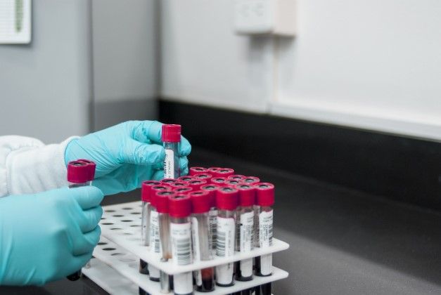 Komunikat Prezesa URPL w sprawie dostarczania i udostępniania laikom wyrobów medycznych do diagnostyki in vitro