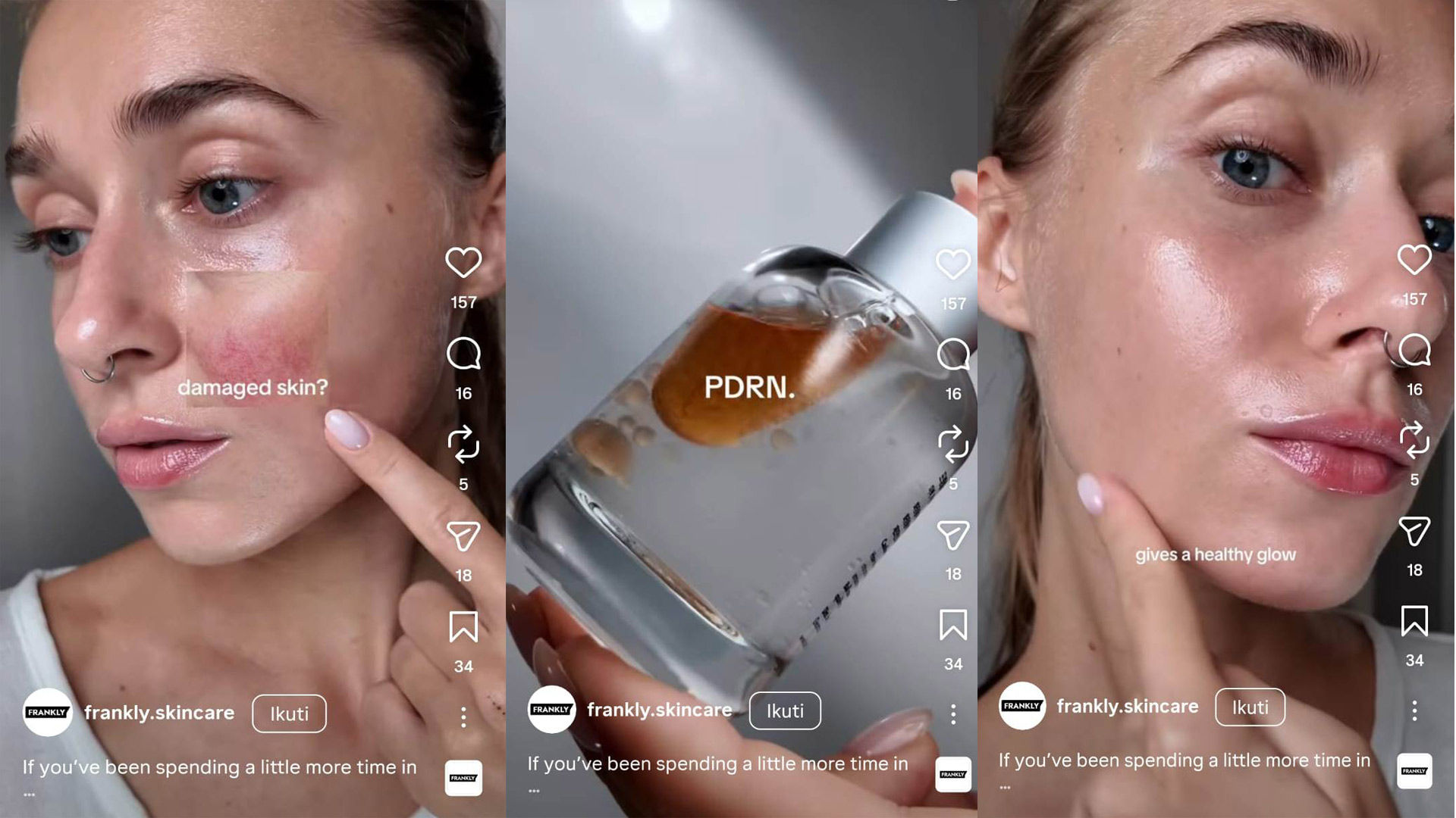 Frankly Instagram ad