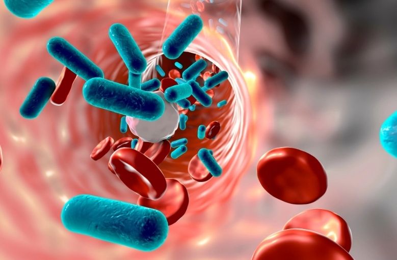 Health News- कोरोना के साथ सेप्सिस (Sepsis) का बढ़ा खतरा