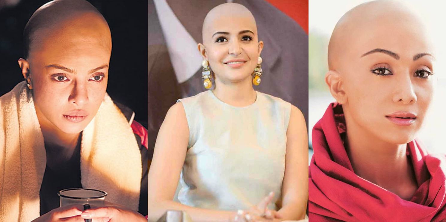 Bollywood : बॉलीवुड की हुस्न की परियाँ क्यों हुईं गंजी?