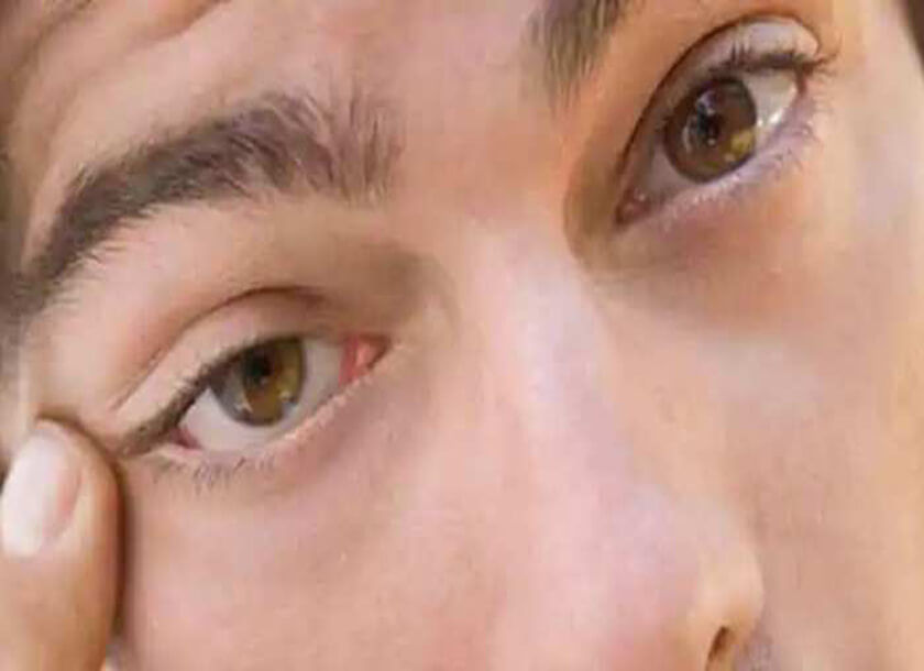 क्यों फड़कती है आंख? शुभ-अशुभ संकेत और वैज्ञानिक कारण