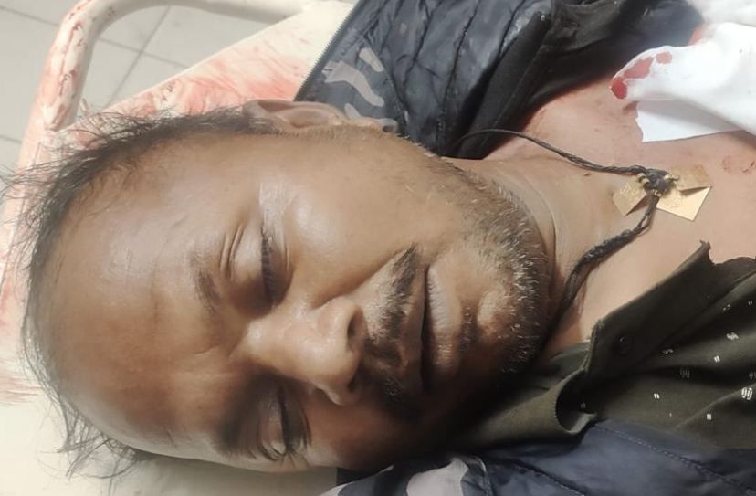 UP News : STF से मुठभेड़ में सवा लाख के इनामी डकैत की मौत, 3 पुलिसकर्मी घायल