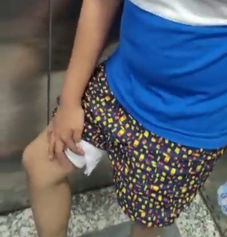 Greater Noida News : एस एस्पायर सोसाइटी में आवारा कुत्ते ने फिर एक बच्चे को काटा ,डर से पार्क नही जा रहे बच्चे