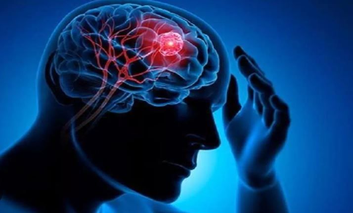 Health News : अब लाइलाज नहीं रहेगा मस्तिष्क कैंसर, भारतीय वैज्ञानिकों ने की खोज