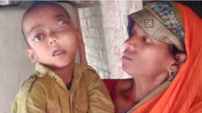 UP News: बेरहम लेडी टीचर ने फोड़ दी बच्चे की आंख, मुकदमा हुआ दर्ज