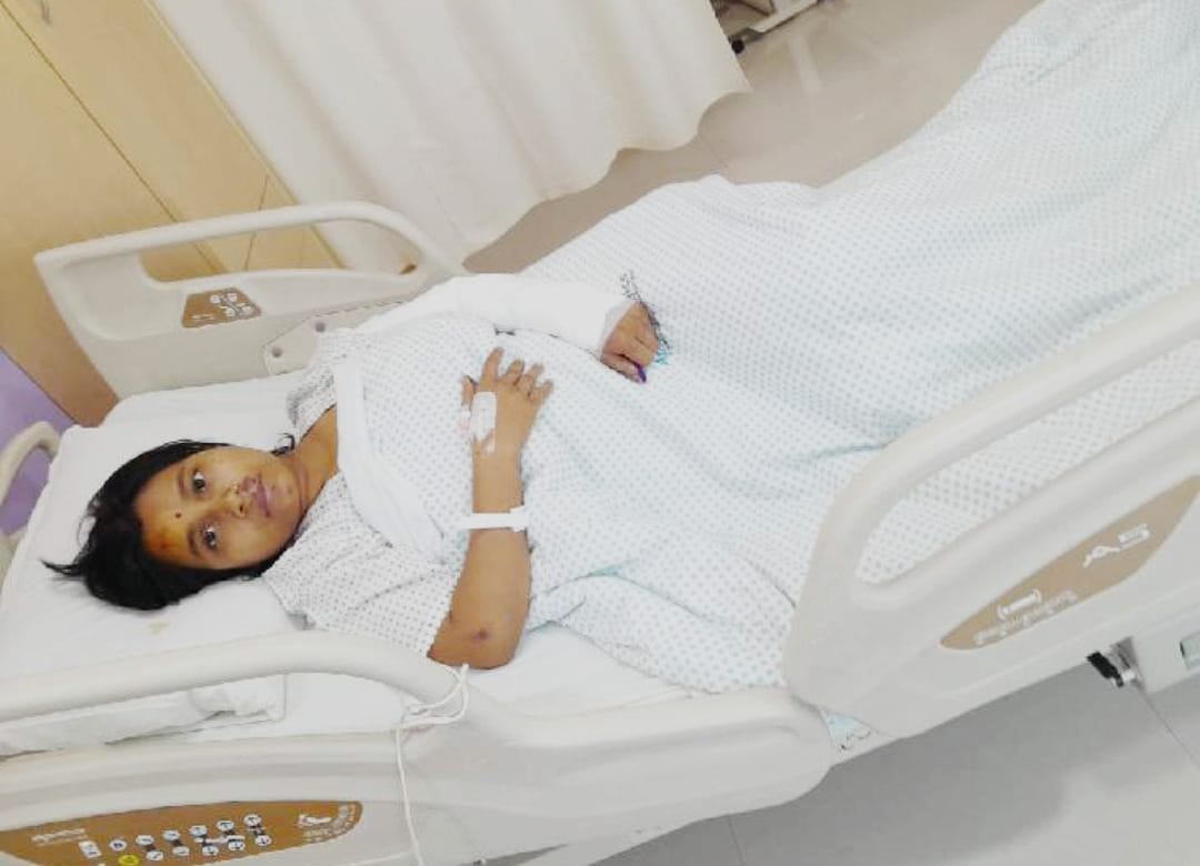 Lucknow News : राजधानी में लुटेरों का दुस्साहस, चलती स्कूटी पर मारा झपट्टा, महिला और बच्चा घायल