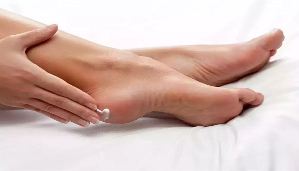 इन घरेलू नुस्खों से मिल सकता है फटी एड़ियों से छुटकरा!