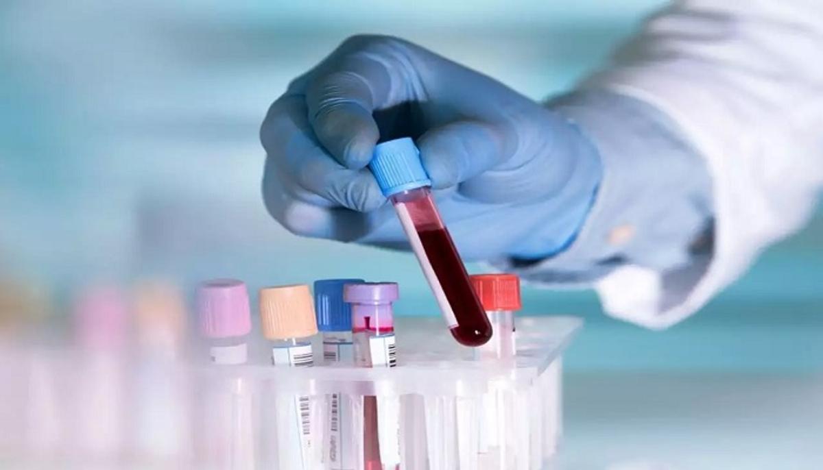 यूपी के मरीजों को अब घर बैठे मिलेगी ब्लड रिपोर्ट, ये है प्रक्रिया